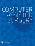 Computer Assisted Surgery